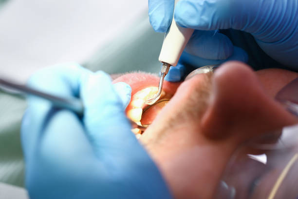 Best Weekend Emergency Dentist in Frankl, IN