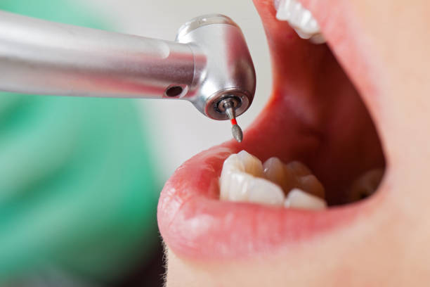 Best Emergency Cosmetic Dentistry in Frankl, IN